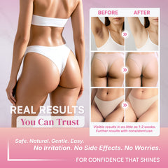 SB Skin Brightening Gel para zonas sensibles