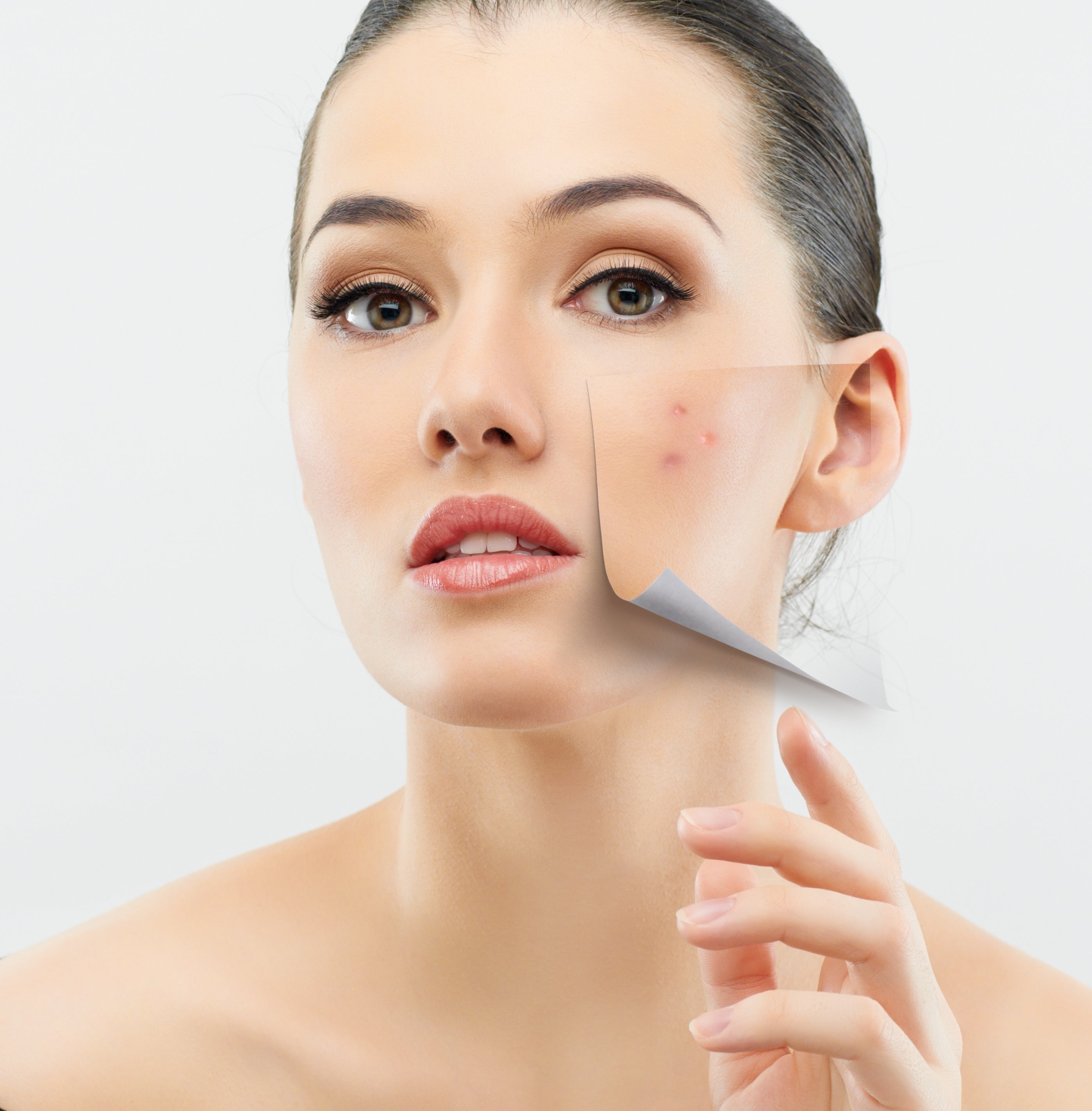The Impact of Stress on Your Skin and How to Combat It