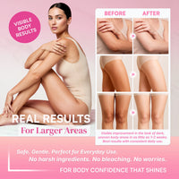 SB Skin Brightening Body Milk para rodillas, codos y parte interna de los muslos