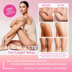 SB Skin Brightening Body Milk para rodillas, codos y parte interna de los muslos